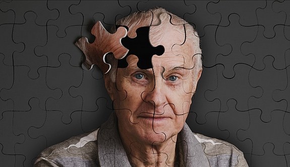 Alzheimer'ın tedavisi artık mümkün
