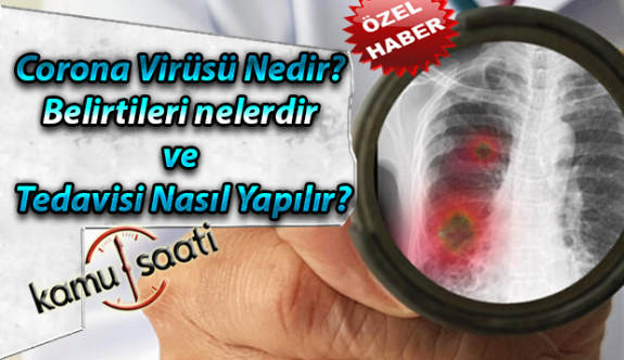 Corona Virüsü Nedir? Korona Virüsü Belirtileri Nelerdir ve Korona Virüs Tedavisi Nasıl Yapılır?