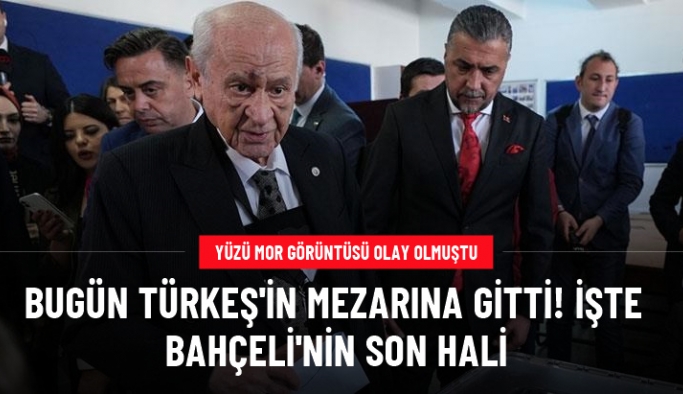 Yüzü mor görüntüleri gündem olmuştu! İşte MHP lideri Devlet Bahçeli'nin son hali